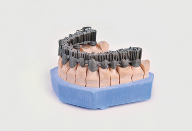 Изготовленные на 3D-принтере EP-M100T хирургические шаблоны для стоматологии