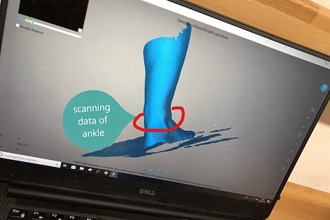 C помощью 3D-сканирования разработана защита для голеностопа